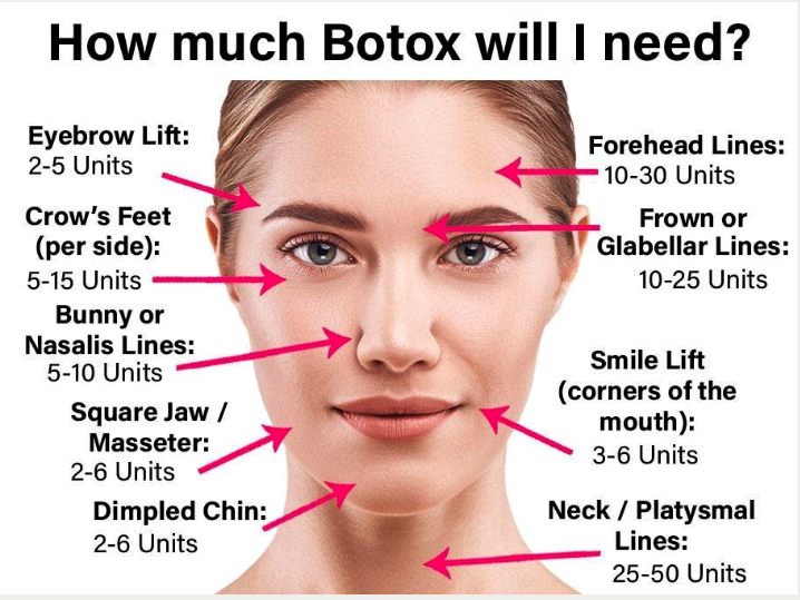 How much botox will i need?