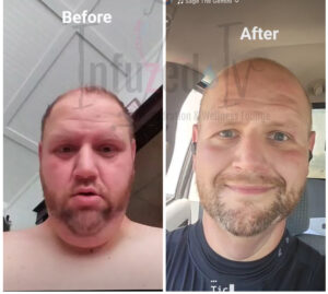 Joel weight loss with semaglutide at infuzed iv bar