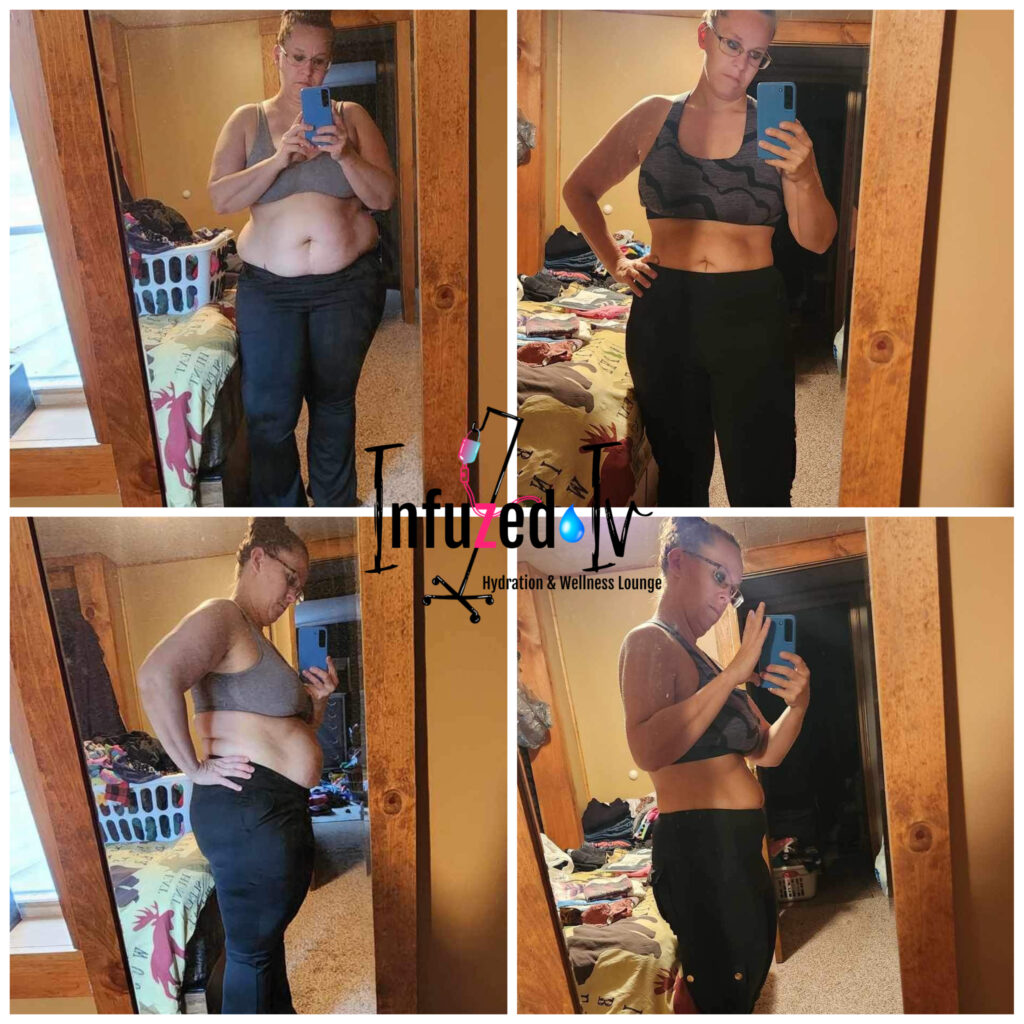 weight loss results at infuzed iv bar in dubois with semaglutide