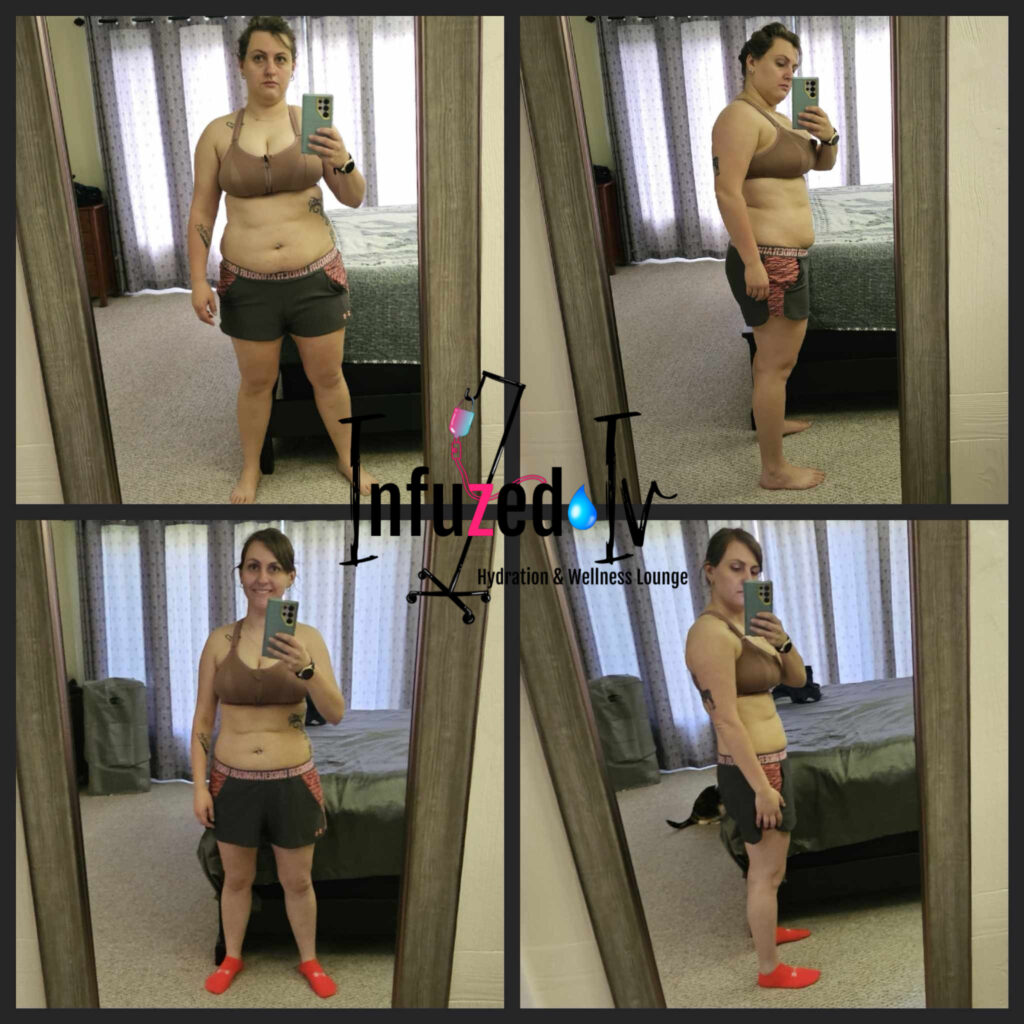 Krista semaglutide before and after