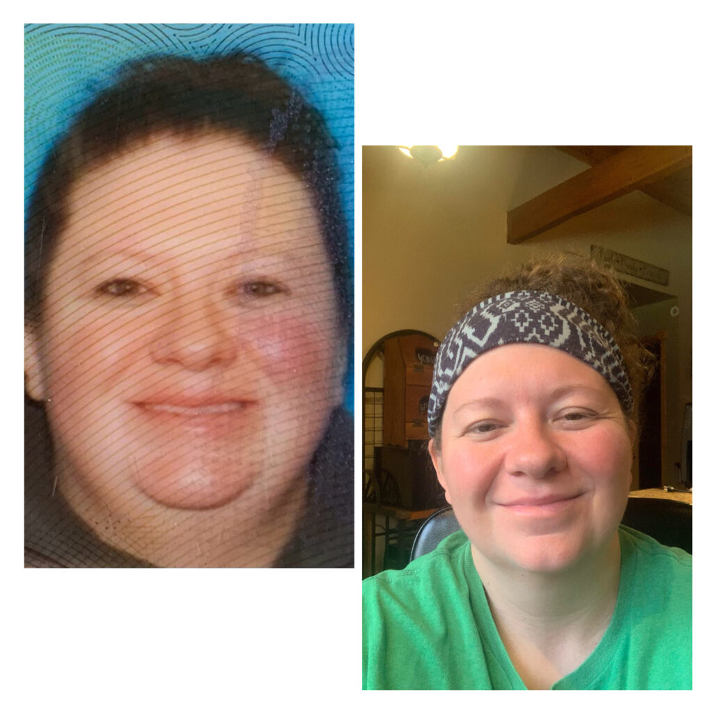 Jennifer before and after semaglutide