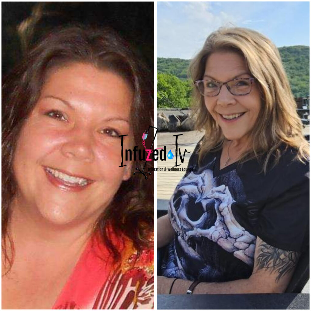 weight loss results at infuzed iv